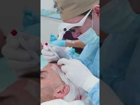 John Robertson chose Seneca for his hair transplant