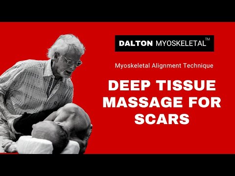 Deep Tissue Massage for Scars - Erik Dalton