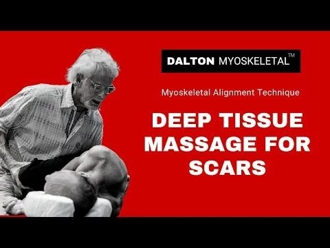 Deep Tissue Massage for Scars - Erik Dalton