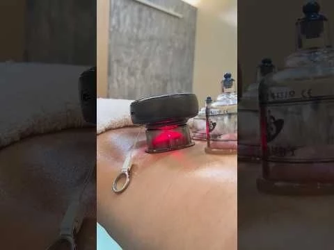 Heated muscle scraping tool combines cupping device for back recovery. #massagetherapy