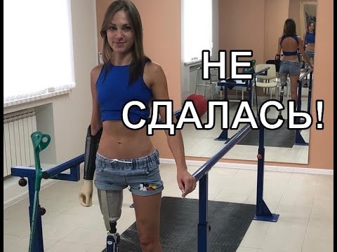 «Не сдалась!» Девушке из Мариуполя, потерявшей руку и ногу, сделали биопротезы