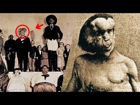 21 Circus Freaks | Historical Photos