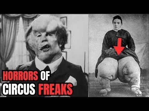 10 Circus freaks That Actually Existed | Shocking photos