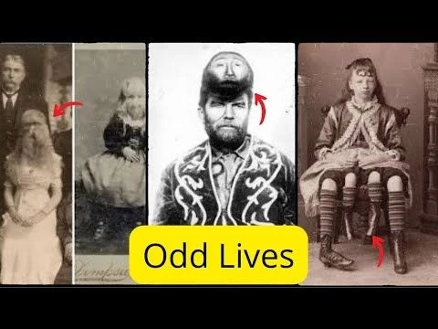 20 Real Circus Freaks You Won#39;t Believe Existed! Shocking Historical Photos!