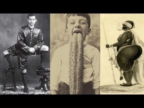Rare SHOCKING History Photos of Unbelievable Circus Freaks That Actually Existed