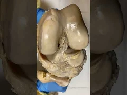 BIOMECHANICS OF KNEE JOINT #viral #trending #shortsvideo #biomechanics of knee joint #knee joint