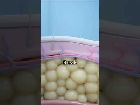 How body burns fat !