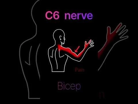 pinched nerve in the neck? #shorts