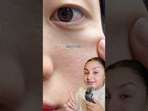 1 Pharmacy Cream for Multiple Skin Concerns ! #skincare #facedecor #bumpychin #openpores