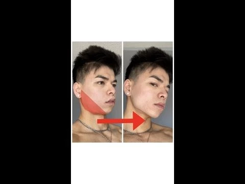 HOW DO I GET A SHARPER JAWLINE WITHOUT SURGERY?