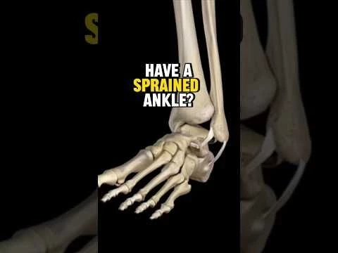 How to Fix A Sprained Ankle (3 STEPS)