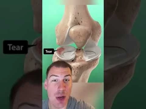 Knee Clicking