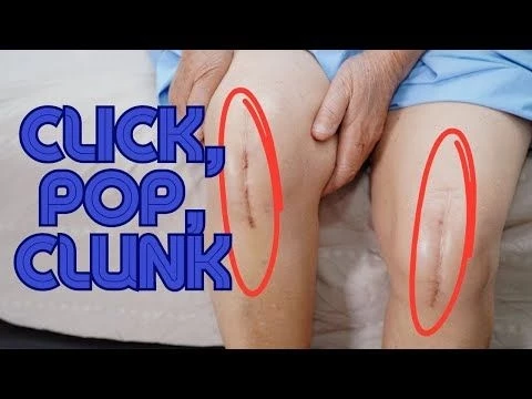 Why is your Knee Replacement Clicking, Popping, or Clunking??