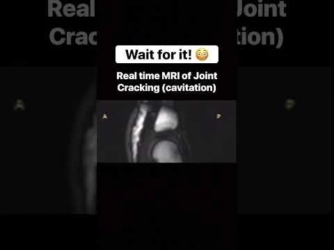 It’s not the bones cracking! The cracking sound comes from stretching the joints!
