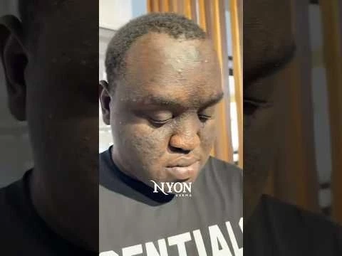 Hyperpigmentation facial that works. #asmr #skincare #facial #nyonderma #chemicalpeeling