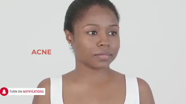 16 BEST 2 INGREDIENT FACE MASKS FOR CLEAR, GLOWING & HEALTHY SKIN